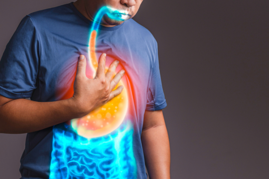 Esophageal Fistula